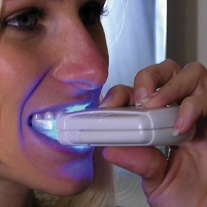 laser-teeth-whitening-home